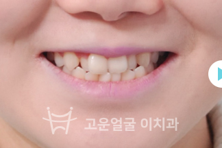 치료사례 이미지